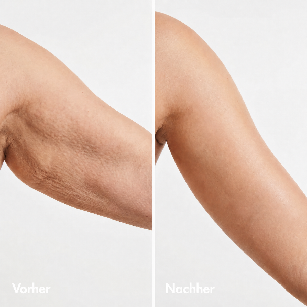 VITALEXA Anti-Aging Körperöl