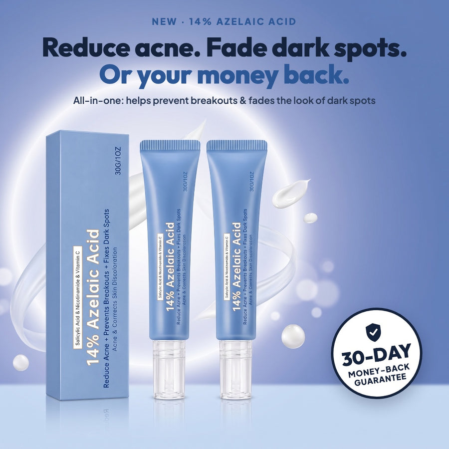 14% Azelaic Acid dark spot cream: fade your dark spots or your money back, 30-day money-back guarantee