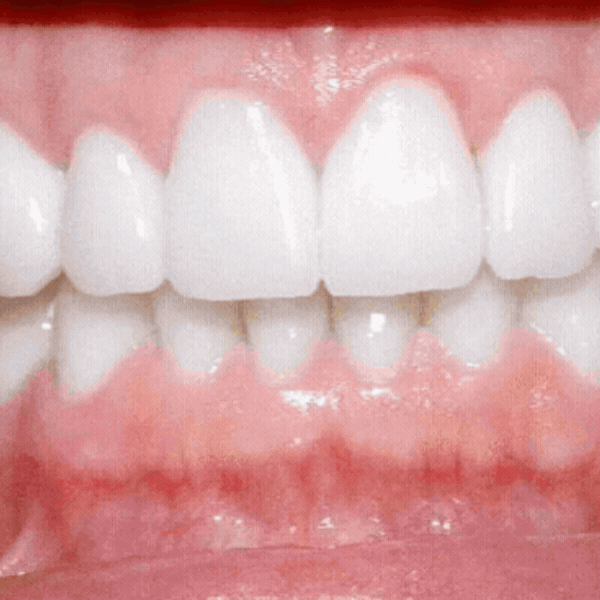 vx-wht-08